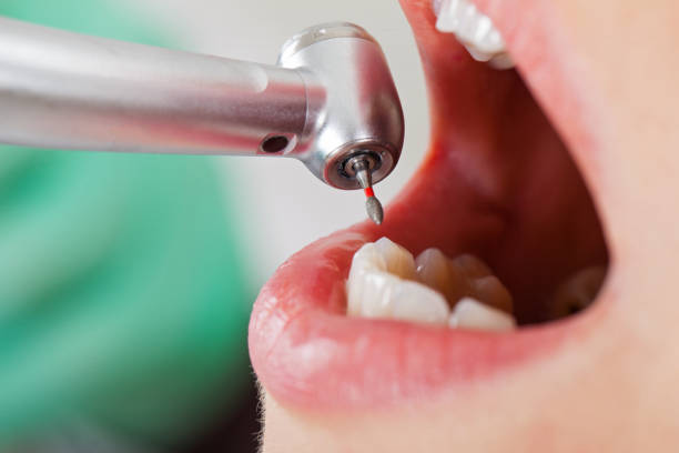 Emergency Dentist Open Today in TN